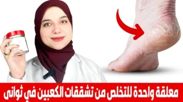 ”وفري فلوس الكريمات” وصفة فعالة 100% لعلاج تقششات الكعبين من اول إستخدام.. جربيها حالا