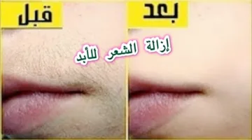 بملعقة واحدة من الملح لإزالة الشعر الزائد نهائيا من الوجه والجسم من الجذور وتبيض فوري للمناطق الغامقة لن يعود مجدداً 