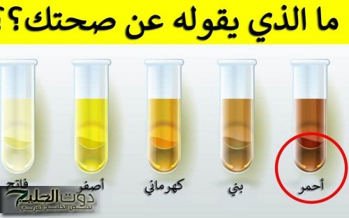 تحذير عاجل.. علامة في لون البول تكشف وجود مشكلة خطيرة في الكلى والكبد
